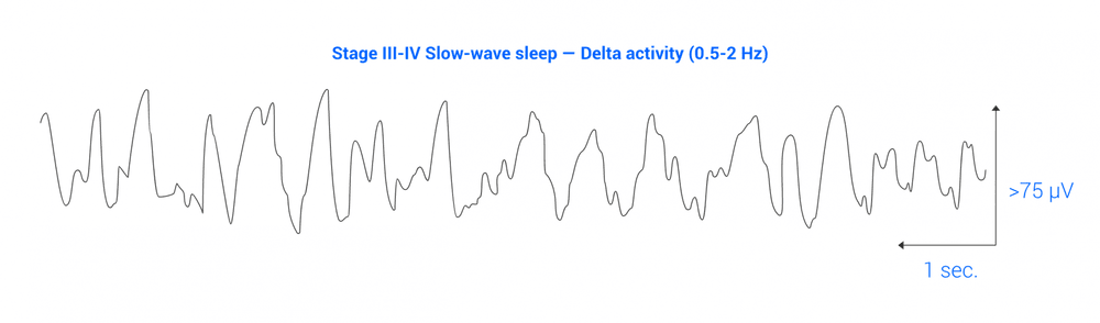 Sleep Eeg Graph 4